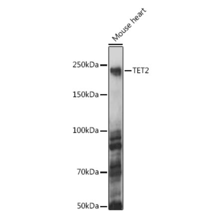 Western Blot - Anti-Tet2 Antibody (A88569) - Antibodies.com