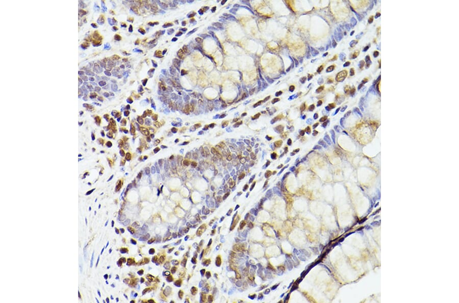 Immunohistochemistry - Anti-Tet2 Antibody (A88569) - Antibodies.com