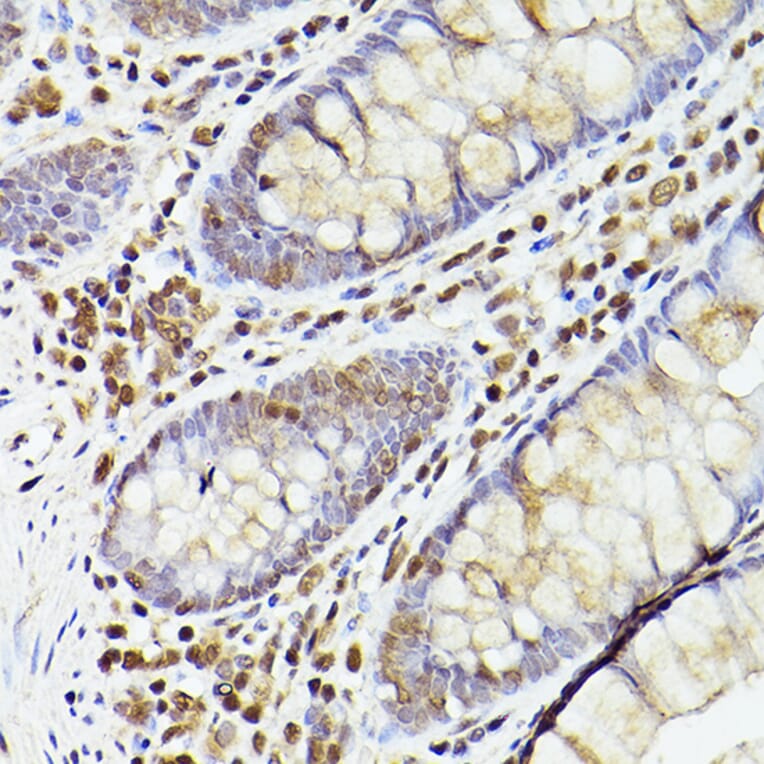 Immunohistochemistry - Anti-Tet2 Antibody (A88569) - Antibodies.com