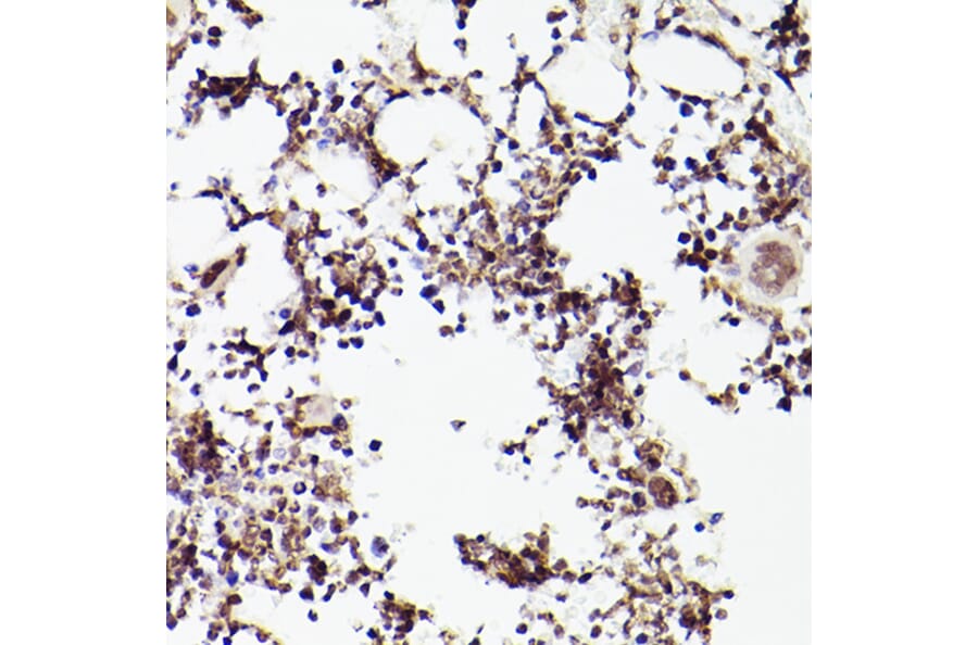 Immunohistochemistry - Anti-Tet2 Antibody (A88569) - Antibodies.com