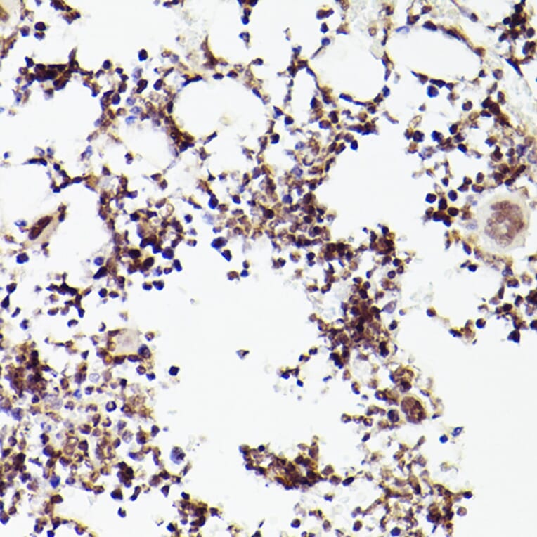 Immunohistochemistry - Anti-Tet2 Antibody (A88569) - Antibodies.com