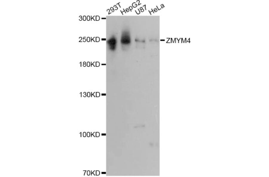 Western Blot - Anti-ZMYM4 Antibody (A13812) - Antibodies.com