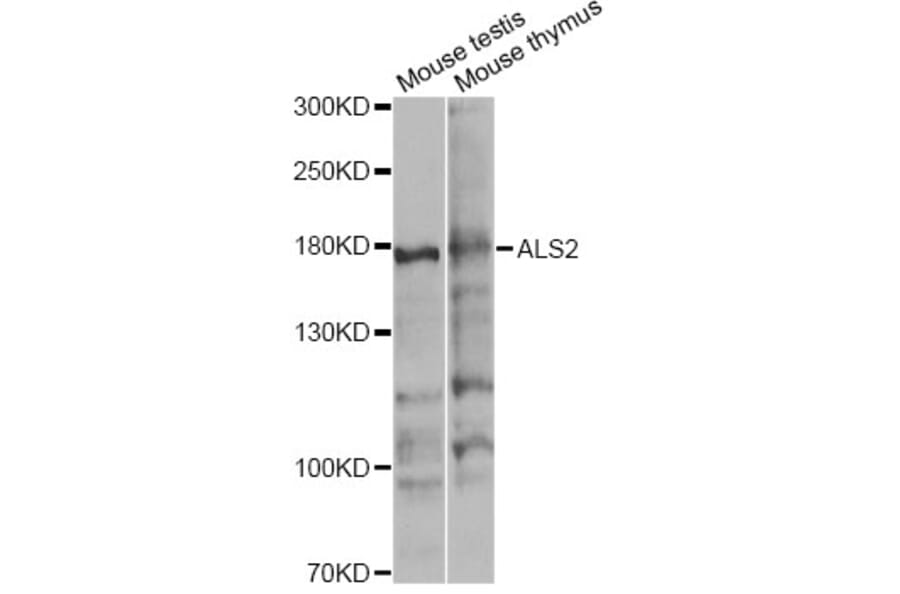 Western Blot - Anti-ALS2 Antibody (A4895) - Antibodies.com