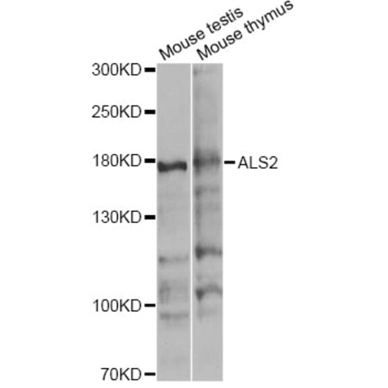 Western Blot - Anti-ALS2 Antibody (A4895) - Antibodies.com