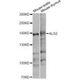 Western Blot - Anti-ALS2 Antibody (A4895) - Antibodies.com
