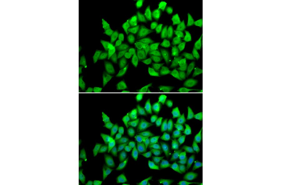 Immunofluorescence - Anti-ALS2 Antibody (A4895) - Antibodies.com