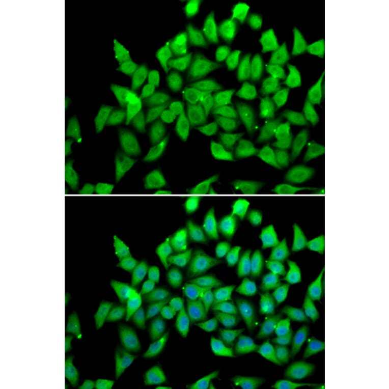 Immunofluorescence - Anti-ALS2 Antibody (A4895) - Antibodies.com