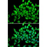 Immunofluorescence - Anti-ALS2 Antibody (A4895) - Antibodies.com