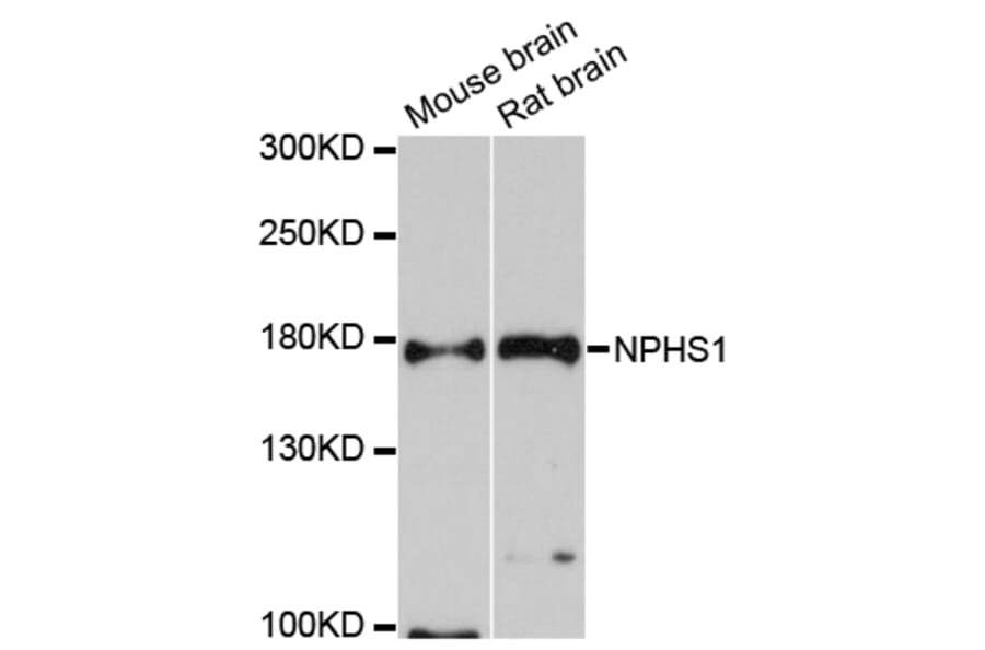 Western Blot - Anti-NPHS1 Antibody (A12467) - Antibodies.com