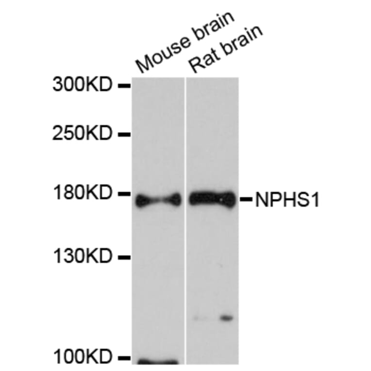 Western Blot - Anti-NPHS1 Antibody (A12467) - Antibodies.com