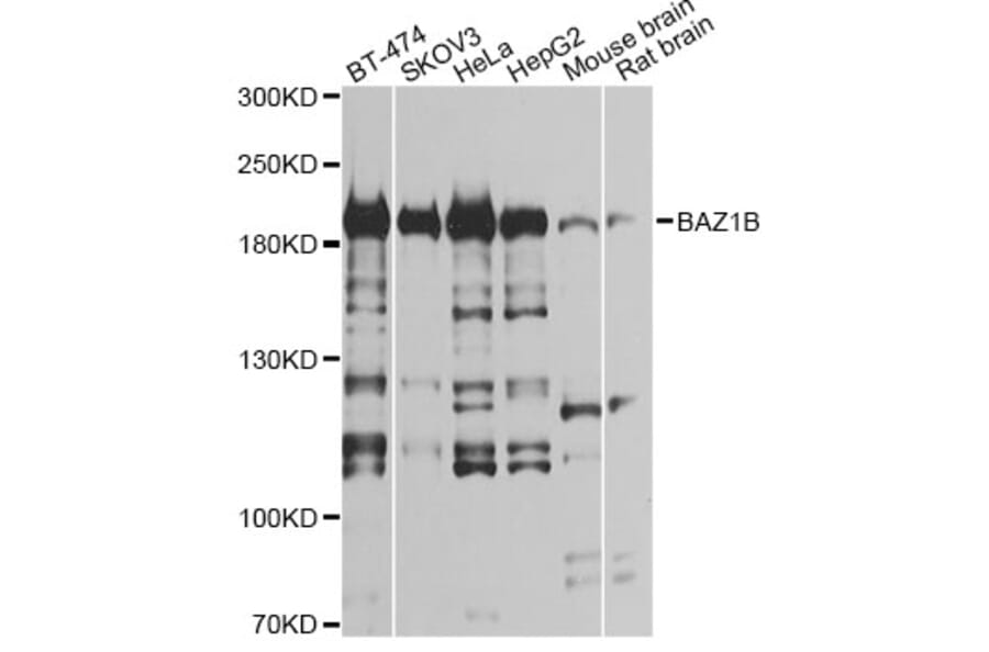 Western Blot - Anti-BAZ1B Antibody (A12545) - Antibodies.com