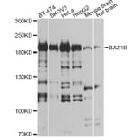 Western Blot - Anti-BAZ1B Antibody (A12545) - Antibodies.com