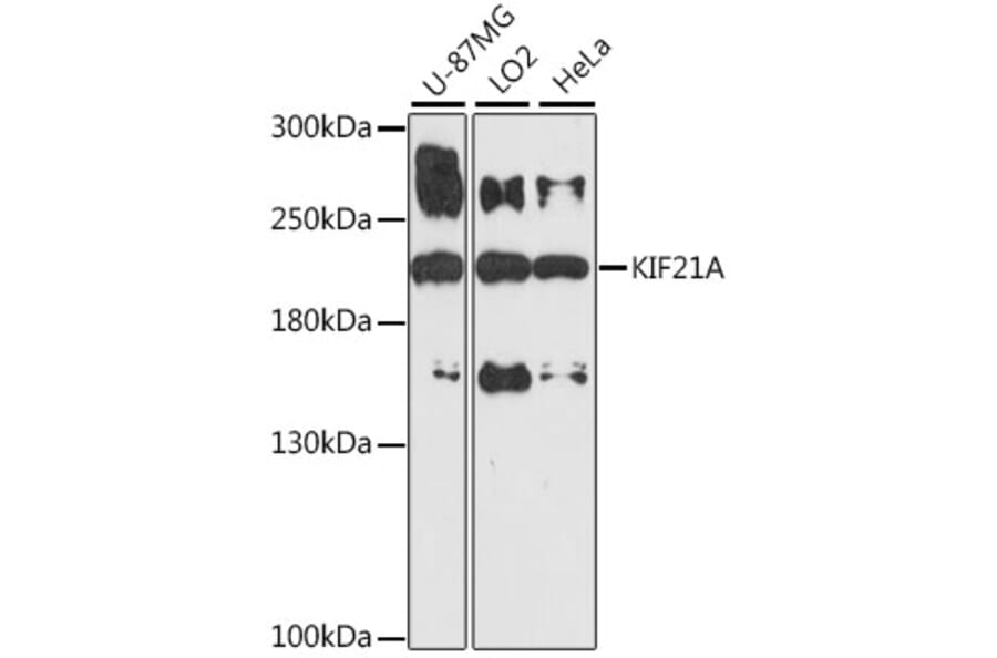 Western Blot - Anti-KIF21A Antibody (A88575) - Antibodies.com