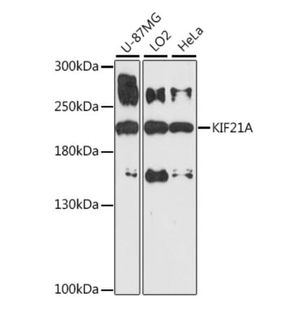 Western Blot - Anti-KIF21A Antibody (A88575) - Antibodies.com