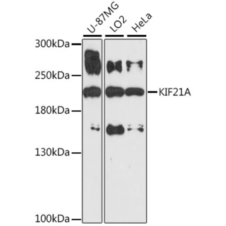 Western Blot - Anti-KIF21A Antibody (A88575) - Antibodies.com
