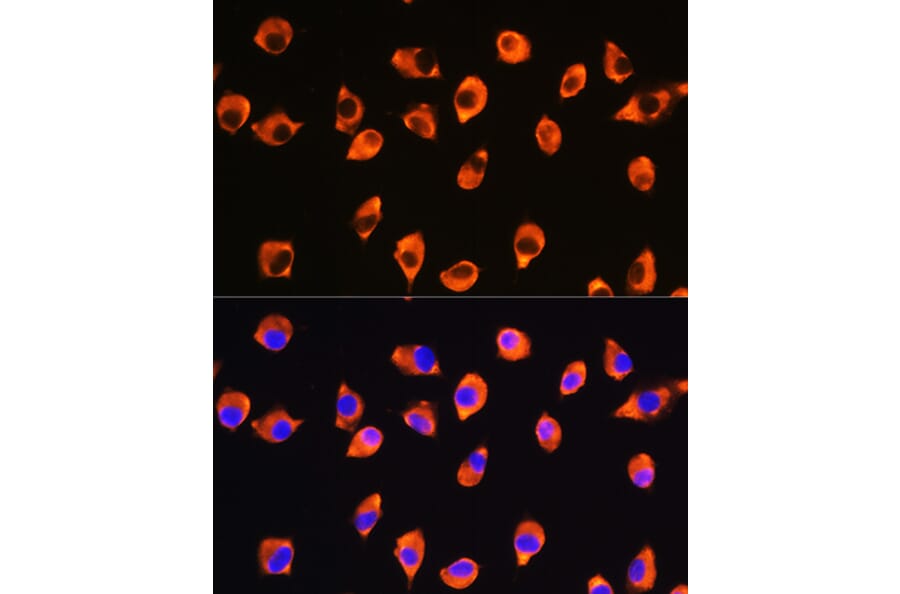 Immunofluorescence - Anti-KIF21A Antibody (A88575) - Antibodies.com