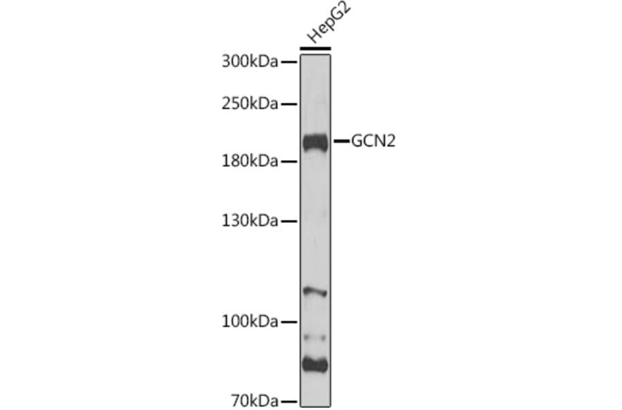 Western Blot - Anti-GCN2 Antibody (A88576) - Antibodies.com
