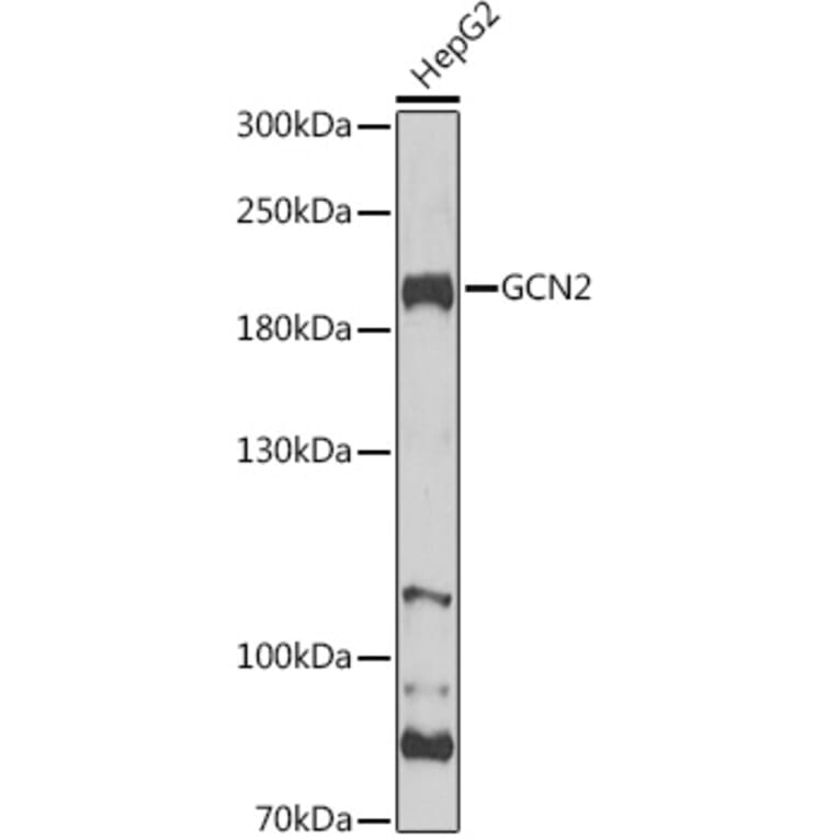 Western Blot - Anti-GCN2 Antibody (A88576) - Antibodies.com
