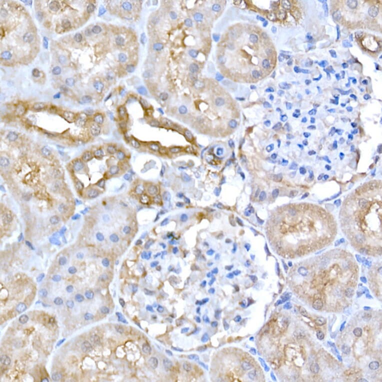 Immunohistochemistry - Anti-GCN2 Antibody (A88576) - Antibodies.com