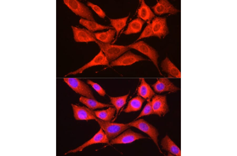 Immunofluorescence - Anti-GCN2 Antibody (A88576) - Antibodies.com