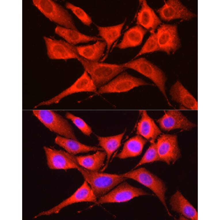 Immunofluorescence - Anti-GCN2 Antibody (A88576) - Antibodies.com