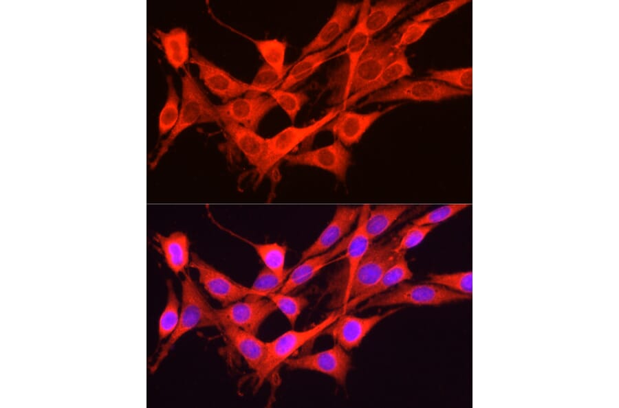 Immunofluorescence - Anti-GCN2 Antibody (A88576) - Antibodies.com