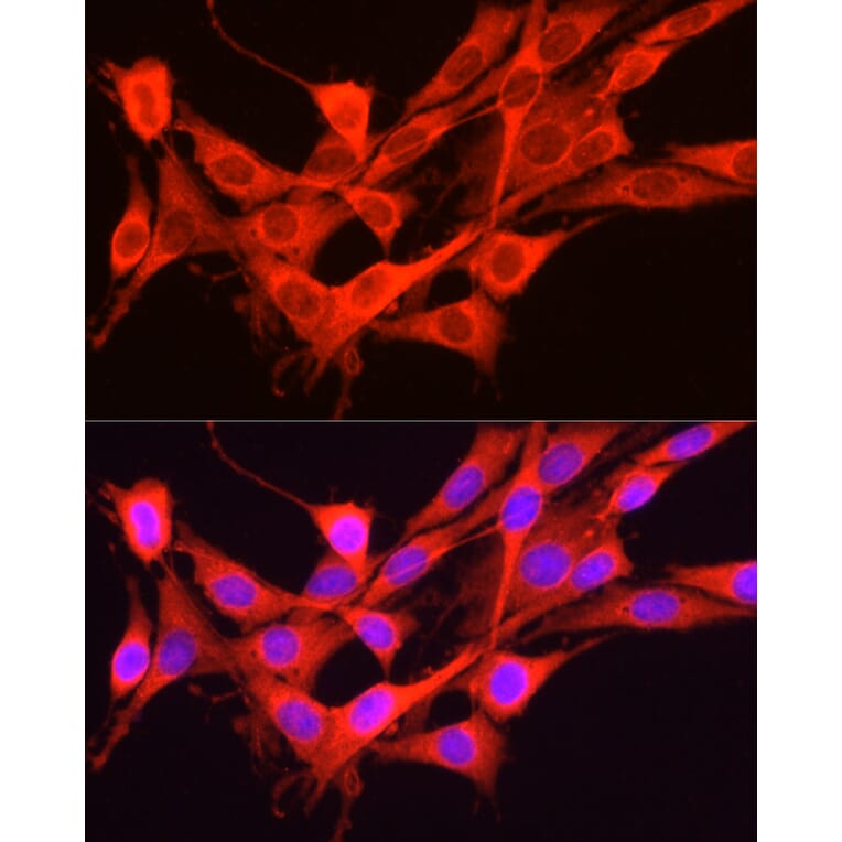 Immunofluorescence - Anti-GCN2 Antibody (A88576) - Antibodies.com