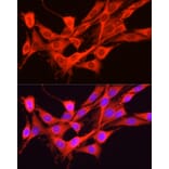 Immunofluorescence - Anti-GCN2 Antibody (A88576) - Antibodies.com
