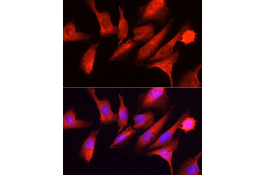 Immunofluorescence - Anti-GCN2 Antibody (A88576) - Antibodies.com
