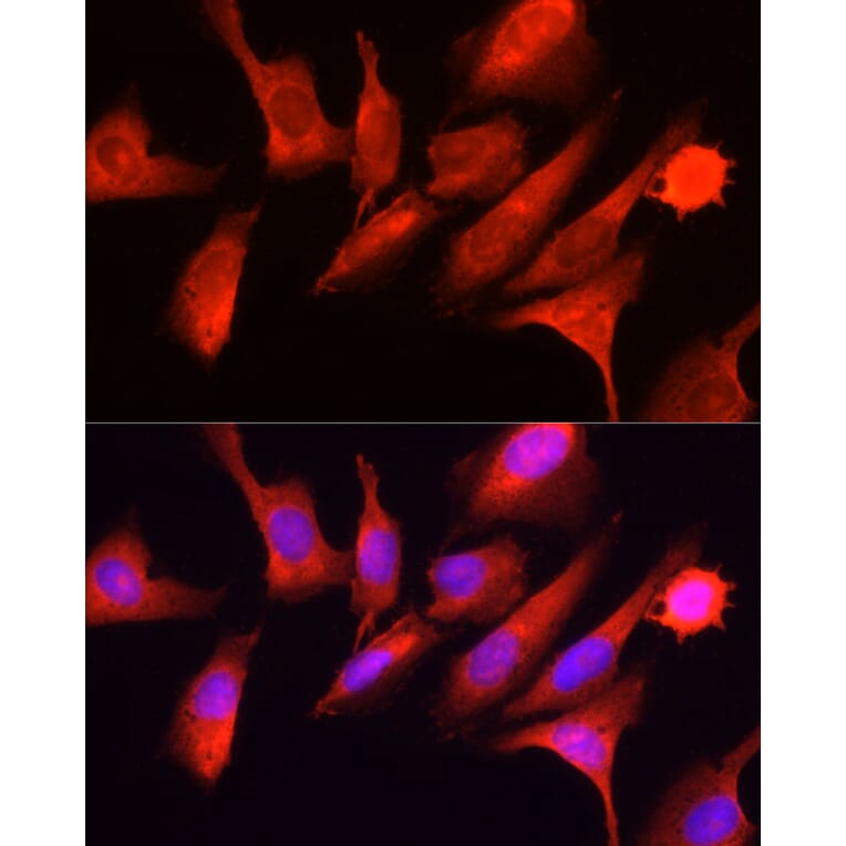 Immunofluorescence - Anti-GCN2 Antibody (A88576) - Antibodies.com