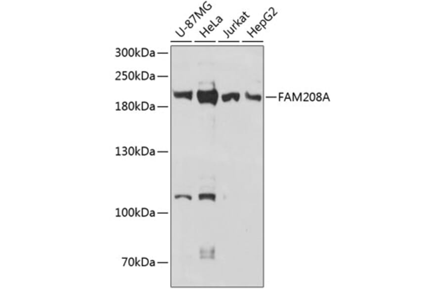 Western Blot - Anti-FAM208A Antibody (A88578) - Antibodies.com