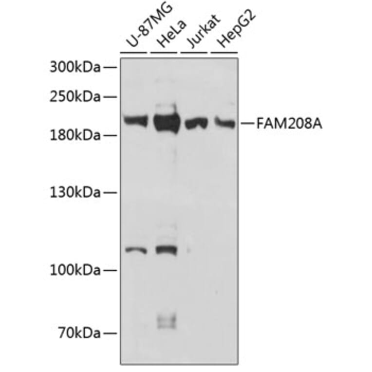 Western Blot - Anti-FAM208A Antibody (A88578) - Antibodies.com