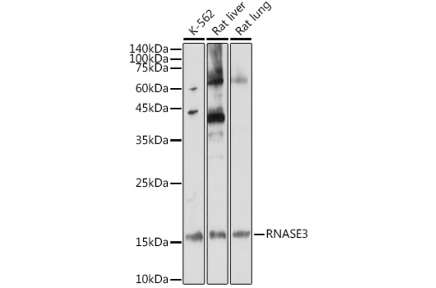 Western Blot - Anti-Ribonuclease 3/ECP Antibody (A88579) - Antibodies.com