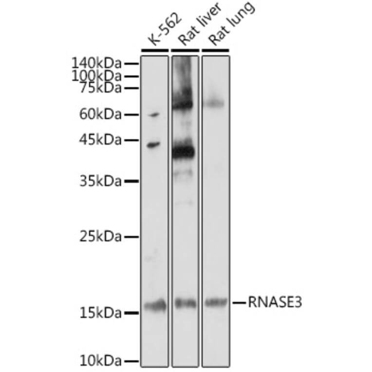 Western Blot - Anti-Ribonuclease 3/ECP Antibody (A88579) - Antibodies.com