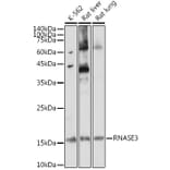 Western Blot - Anti-Ribonuclease 3/ECP Antibody (A88579) - Antibodies.com