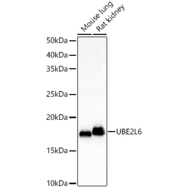 Western Blot - Anti-Ube2L6 Antibody (A88581) - Antibodies.com