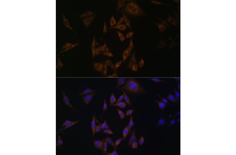 Immunofluorescence - Anti-Ube2L6 Antibody (A88581) - Antibodies.com