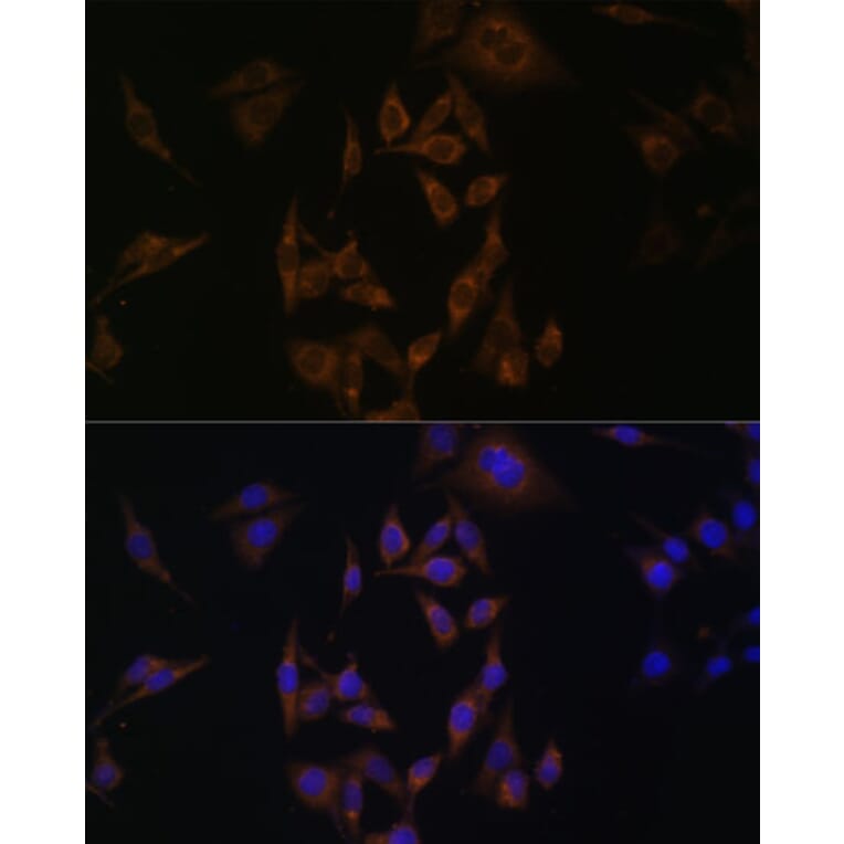 Immunofluorescence - Anti-Ube2L6 Antibody (A88581) - Antibodies.com