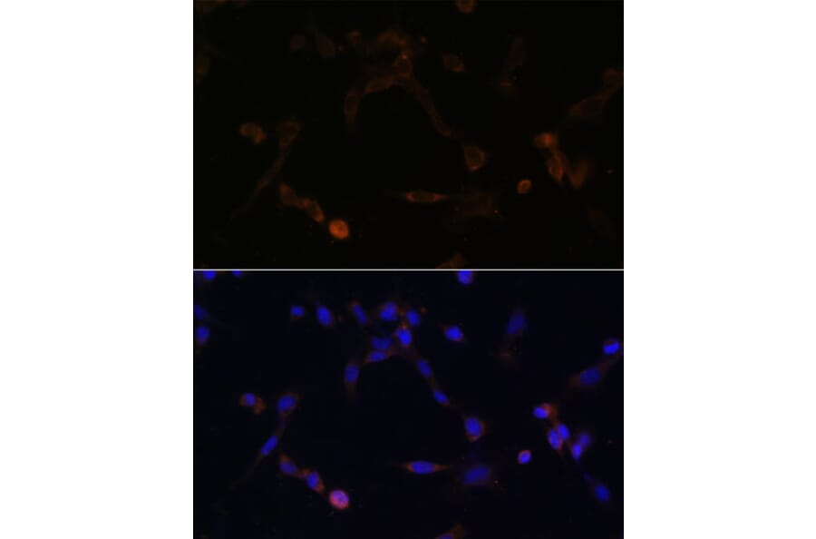 Immunofluorescence - Anti-Ube2L6 Antibody (A88581) - Antibodies.com