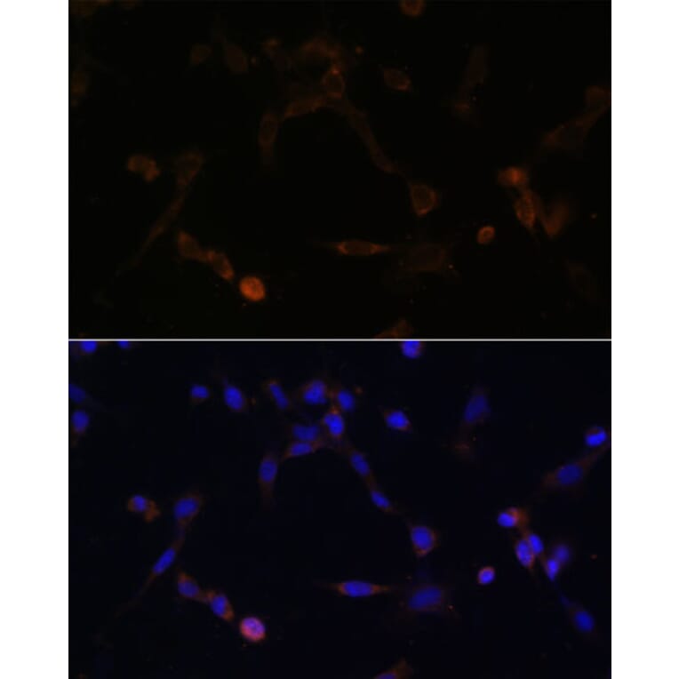 Immunofluorescence - Anti-Ube2L6 Antibody (A88581) - Antibodies.com