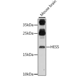 Western Blot - Anti-HES5 Antibody (A88582) - Antibodies.com