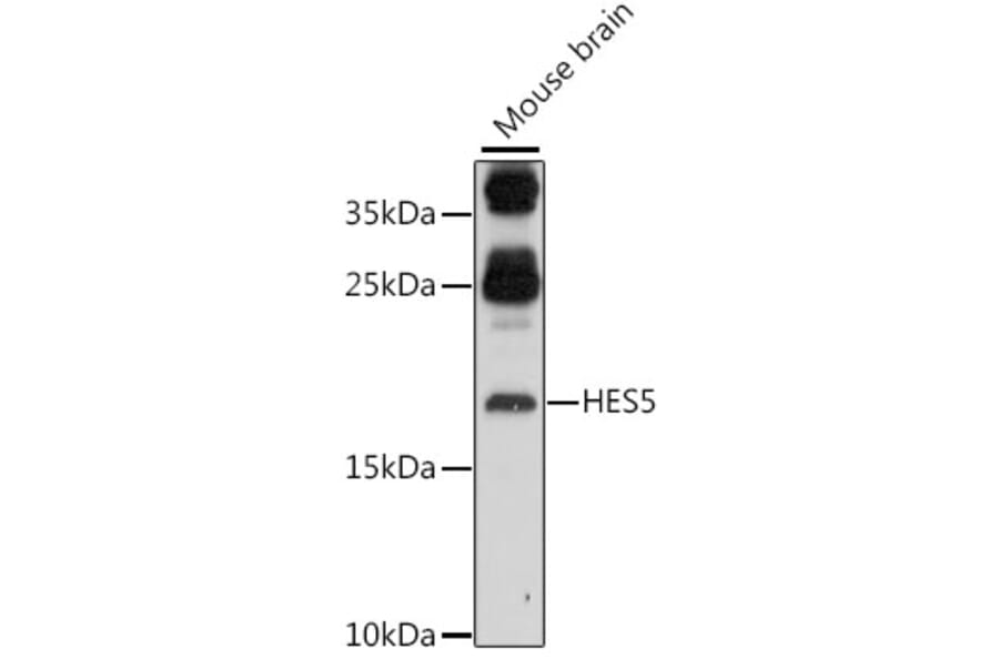 Western Blot - Anti-HES5 Antibody (A88582) - Antibodies.com