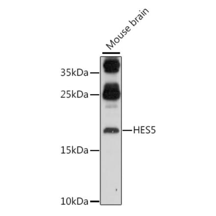 Western Blot - Anti-HES5 Antibody (A88582) - Antibodies.com