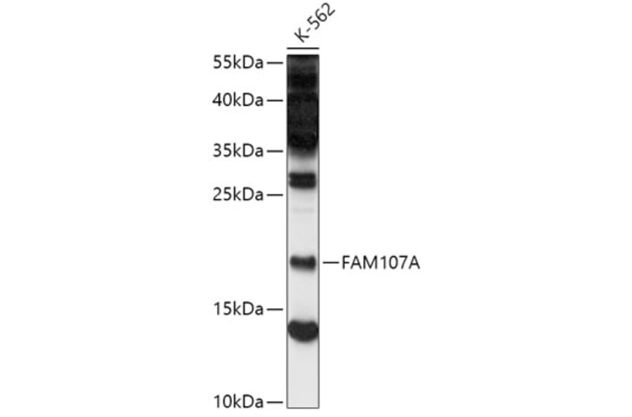 Western Blot - Anti-FAM107A Antibody (A88583) - Antibodies.com