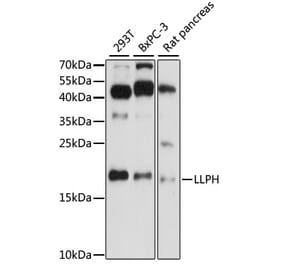 Western Blot - Anti-LLPH Antibody (A88585) - Antibodies.com