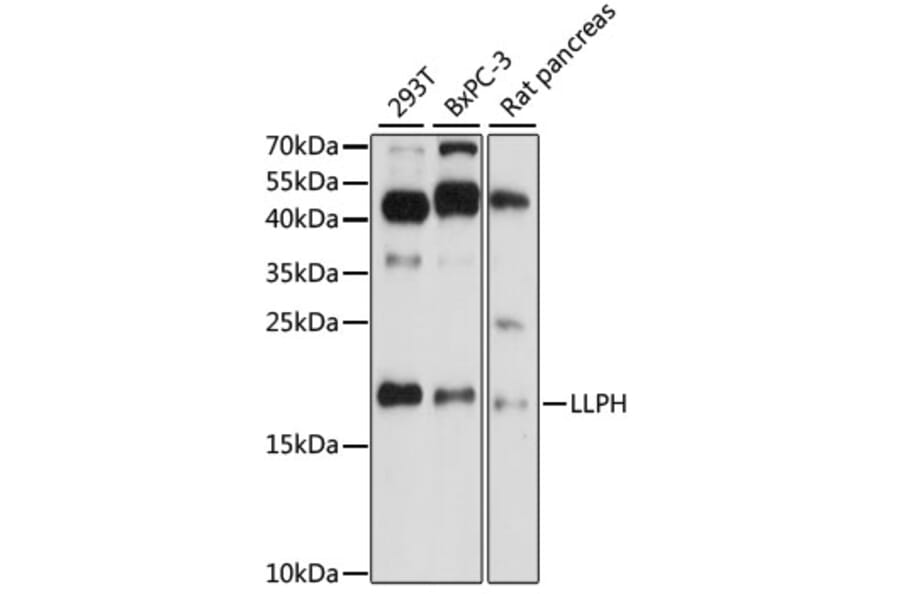 Western Blot - Anti-LLPH Antibody (A88585) - Antibodies.com