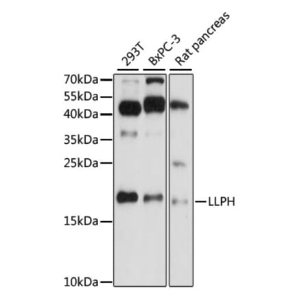 Western Blot - Anti-LLPH Antibody (A88585) - Antibodies.com