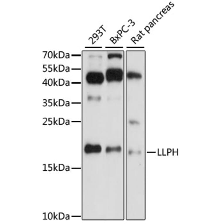 Western Blot - Anti-LLPH Antibody (A88585) - Antibodies.com