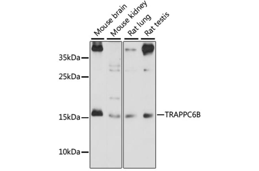 Western Blot - Anti-TRAPPC6B Antibody (A88586) - Antibodies.com