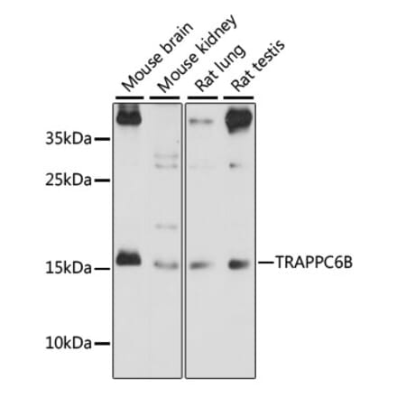 Western Blot - Anti-TRAPPC6B Antibody (A88586) - Antibodies.com